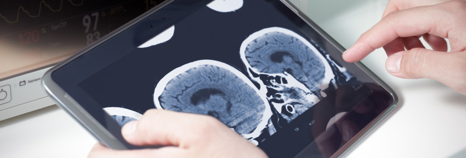doctor examining a brain cat scan on a digital tablet